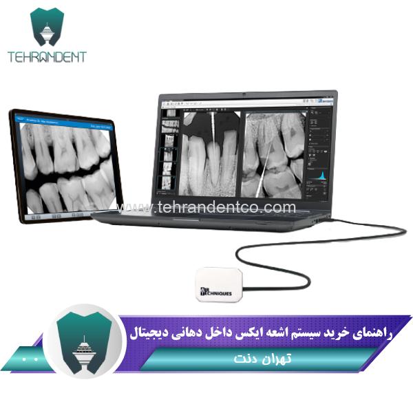 تصویربرداری دیجیتال رادیوگرافی داخل دهانی دندانپزشکی